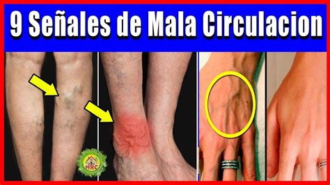 Medicos Suplican Nunca Ignores Estos 9 Sintomas De Que Tienes Mala Circ Youtube Home