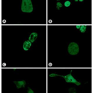 Subcellular Localization Of Wild Type And Mutant Egfp Sf Constructs