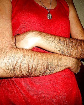Girl With Very Hairy Arms Porn Pictures XXX Photos Sex Images 1304605 PICTOA