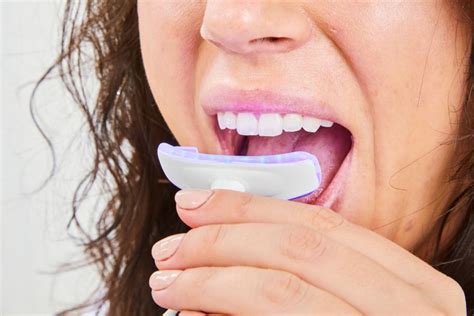 The Best Led Teeth Whitening Kits Of Tested And Reviewed