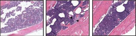 34 Vegf 121 Rgel Inhibits Growth Of Pc 3 Tumor Cells In Bone Hande