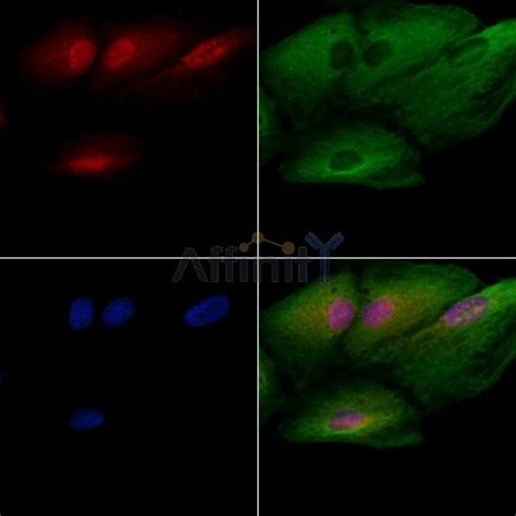 BMAL1 Antibody Affinity Biosciences LTD 亲科生物官网