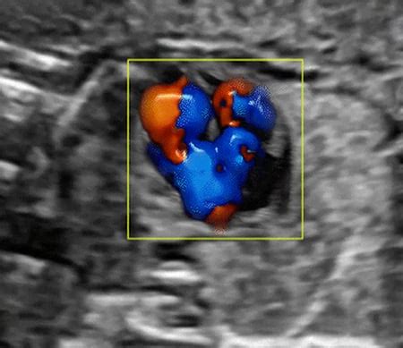 Cardiac Ultrasound Training