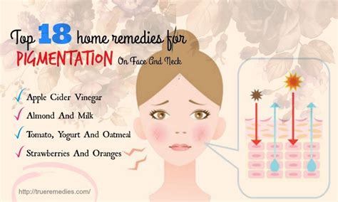 Top 18 Home Remedies For Pigmentation On Face And Neck