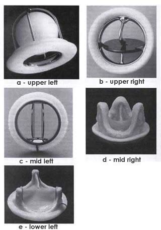 Prosthetic Heart Valves