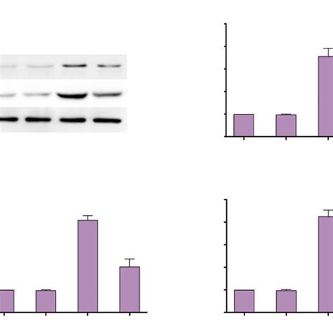 Elevated Endoplasmic Reticulum Stress Response Pathway Related Proteins