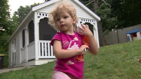 2 Year Old Girl Attacked Bitten By Rabid Skunk In Weymouth