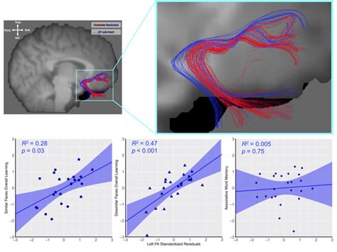 A Tractography Delineating The Right Uncinate Fasciculus Uf Red And