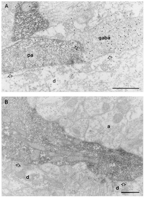 Electron Micrographs Of Primary Afferent Axon Terminals Contacted By