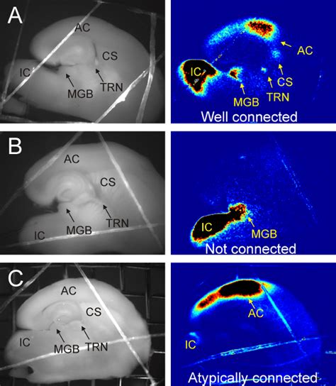 Flavoprotein Autofluorescence Imaging Of Colliculo Thalamocortical