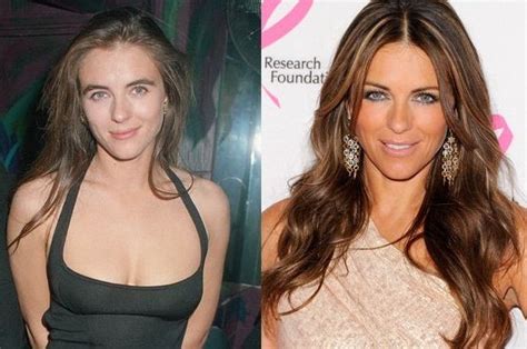 Elizabeth Hurley before and after plastic surgery 27 – Celebrity ...