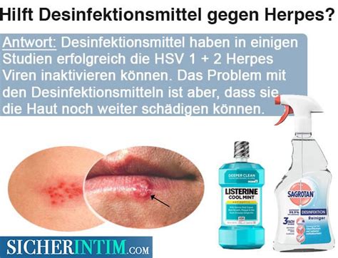 Hilft Desinfektionsmittel Gegen Herpes