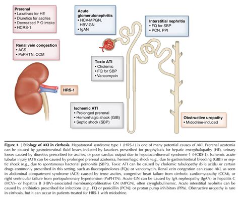 Edgar V Lerma On Twitter Aki In Patients With Liver Cirrhosis Ca