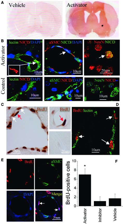 Effects Of Notch Signalling Activation In Vivo On Cerebral Vessels Of