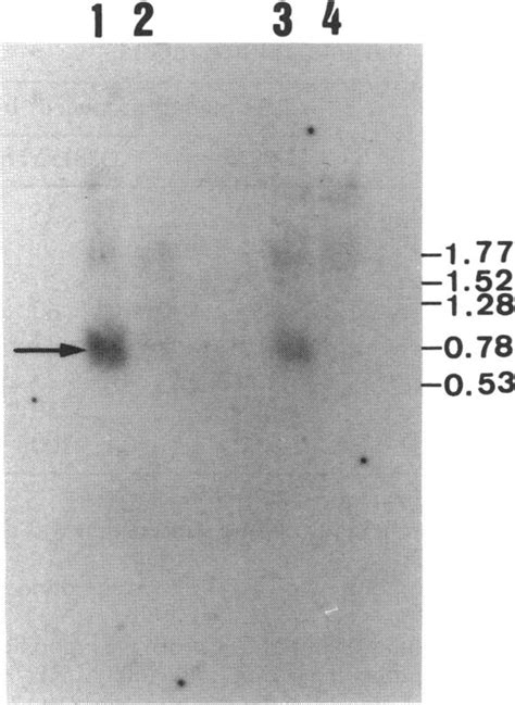 Northern Blot Hybridization Analysis For The Tdh Specific Transcript In