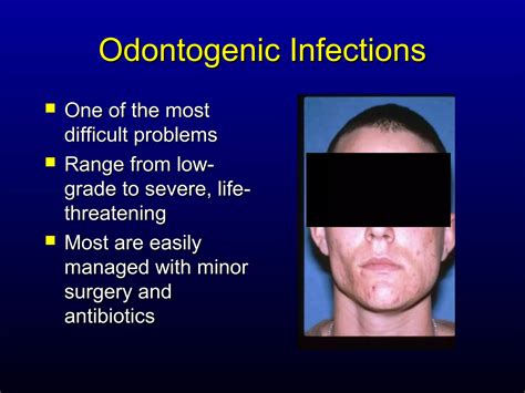 Odontogenic Infections Ppt