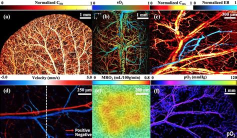 Functional In Vivo Photoacoustic Imaging Of A Normalized Chb In Mouse