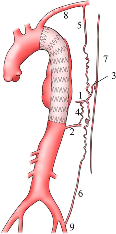 The Society Of Thoracic Surgeons American Association For Thoracic