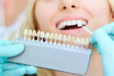 En qué consiste un blanqueamiento dental Tratamiento eficaz BQDC