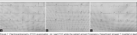 Figure From Isolated Right Ventricular Infarction Without Right