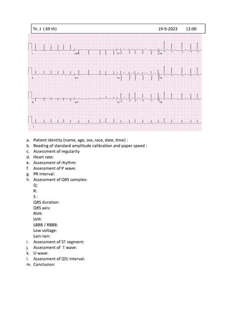 Latihan Ekg Aritmia Oke A Patient Identity Name Age Sex Race Date Time B Reading