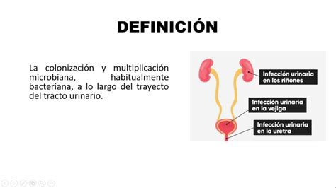 InfecciÓn Del Tracto Urinario Clasificación Etiología Y Patogenia Youtube