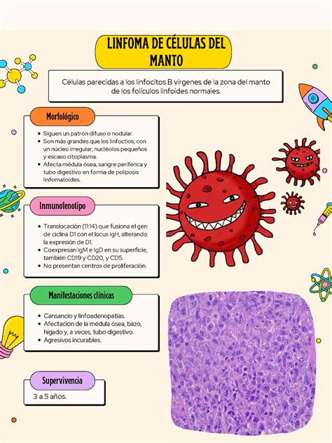 Infografía linfoma de las células de la manto LINFOMA DE CÉLULAS DEL