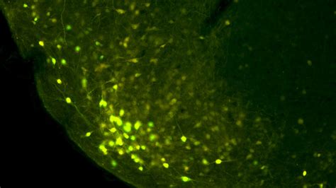 Optical Tools For Visualizing Sex Hormones As Drivers Of Dynamic