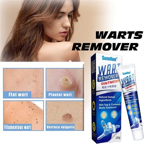 Warts Remover Original Cream Effective Painless Wart Removal Ointment