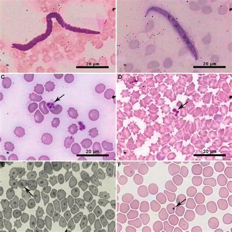 Hematocrit Estimated Hemoglobin Red Blood Cell White Blood Cell And