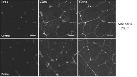 Comparison Of The Enos And Enos P Ser 1177 Enos Phosphorylated On Download Scientific Diagram