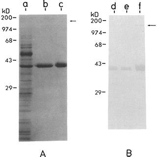 A Coomassie Blue Stain Of SDS Gel And B Western Blot Analysis Of