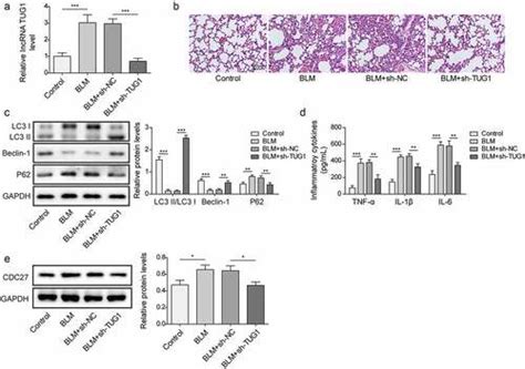 Full Article Lncrna Tug1 Promotes Pulmonary Fibrosis Progression Via