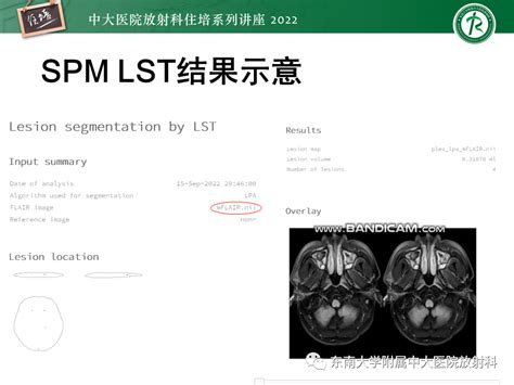 脑小血管病概念、影像维度及其深度学习进展血管病影像大脑健康 健康界