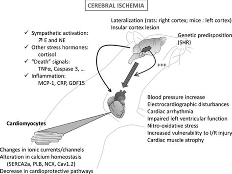 Brain Heart Interactions During Ischemic Processes Stroke