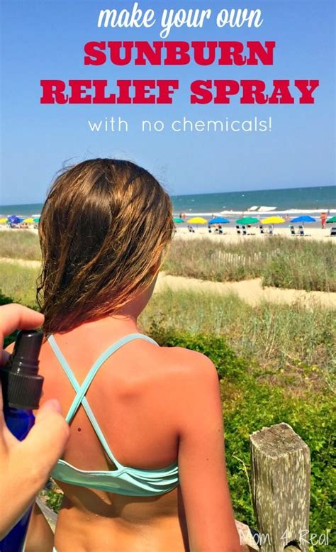 Homemade Sunburn Relief Spray An All Natural Way To Soothe Sunburn So