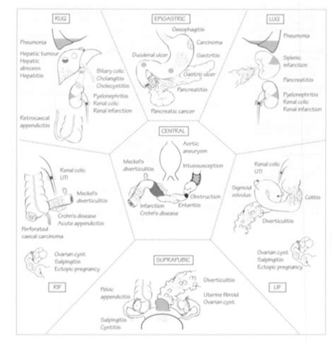 Abdominal Pain Flashcards Quizlet