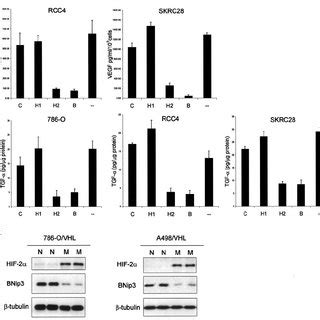 Unusual Patterns Of Hif Dependent Gene Expression In Rcc Cells A