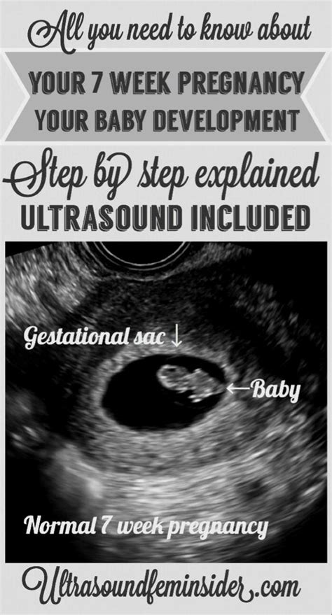 Pinterest 7 Weeks Pregnant Pregnancy Week By Week Ultrasound