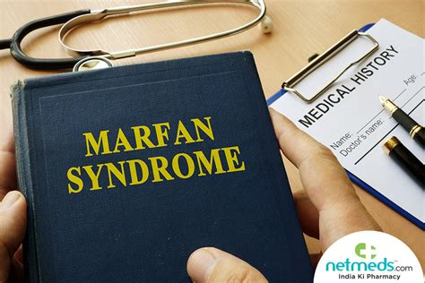 Marfan Syndrome Causes Symptoms And Treatment