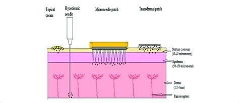 Comparison of topical cream, hypodermic needle, microneedle patch and... | Download Scientific ...