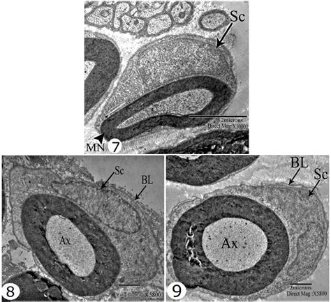 List Pictures What Was Theodor Schwann Contribution To The Cell