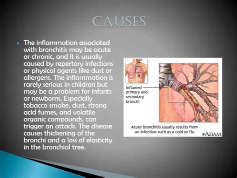 Ppt Bronchitis Powerpoint Presentation Free Download Id 1857220