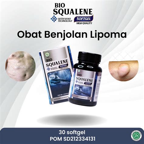 Jual Sapnu Herbal Obat Penghilang Benjolan Di Tubuh Lipoma Uci