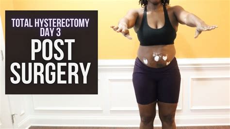 Day 3 Post Laparoscopic Hysterectomy Recovery Removed Fibroids Youtube