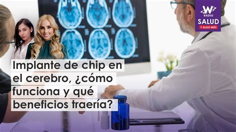 Implante De Chip En El Cerebro C Mo Funciona Y Qu Beneficios Traer A