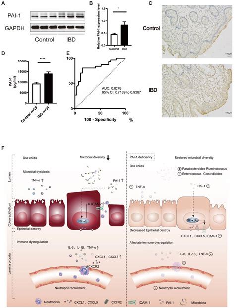 PAI 1 Was Validated As A Potential Biomarker For The Diagnosis Of IBD