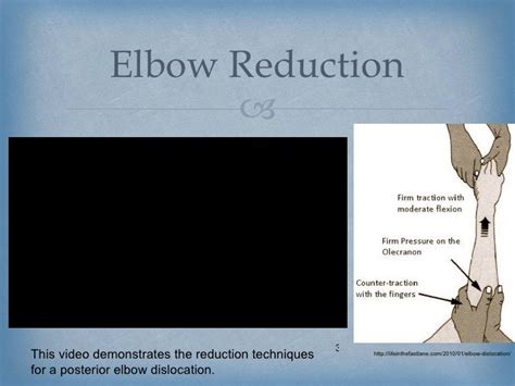 Improving Orthopedic Elbow Reduction Techniques through Clinical Simu…