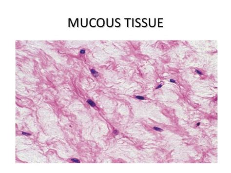 Connective tissue presentation2 | Tissue types, Tissue, Map