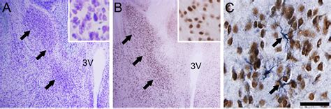 Figure From Sex Differences In NeuN And Androgen Receptorpositive Cells In The Bed Nucleus